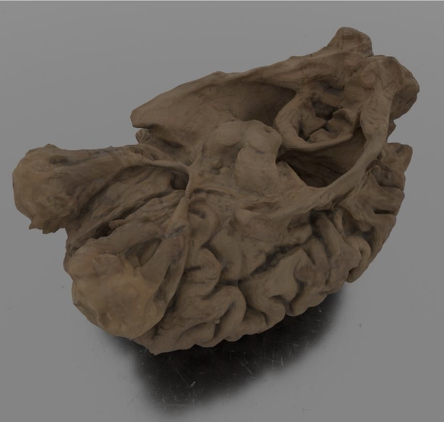 Brain artec scan