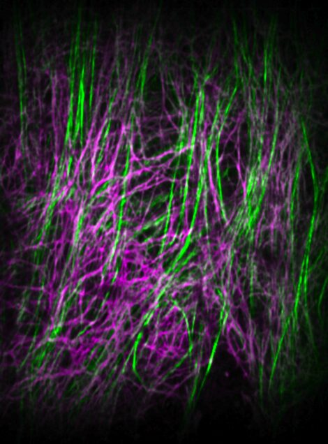 Intertwined elastin (magenta) and collagen (green) fiber networks in the extracellular matrix of an arterial wall captured with multi-photon microscopy.