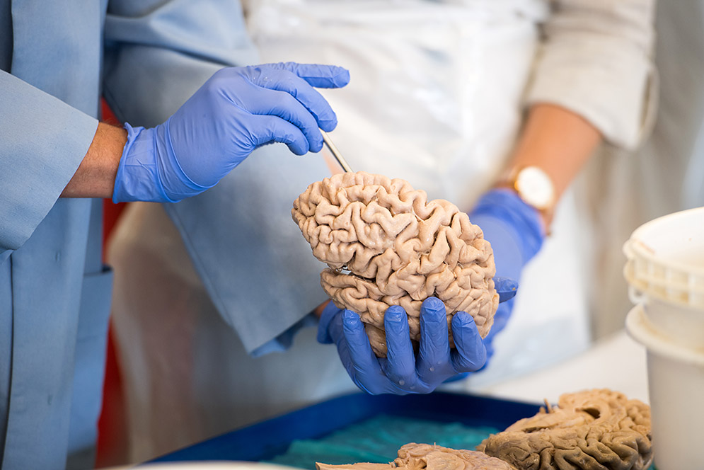 h_butoday_17-1555-BRAINS-056