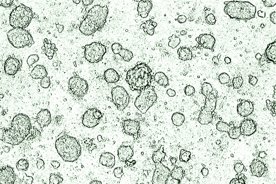 t_stemcells.jpg
