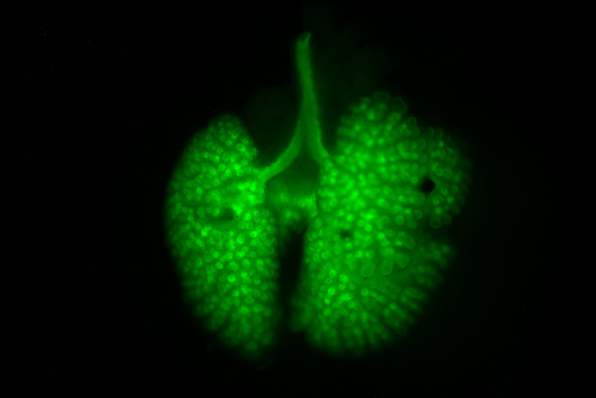 Mouse lungs and trachea Darrell Kotton, Boston University Center for Regenerative Medicine, stem cells, lung cells