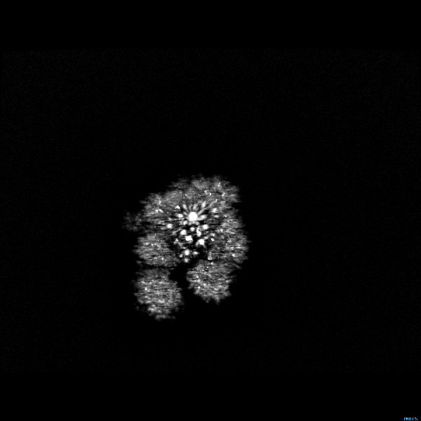 Andrew Ellison, magnetic resonance imaging gif Boston University BU, School of Medicine, Andrew Ellison, magnetic resonance imaging MRI, fruits vegetable imaging