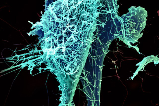 ebola virus particles, ebola hemorrhagic fever, ebola virus disease, ebola virus ecology, ebola virus transmission