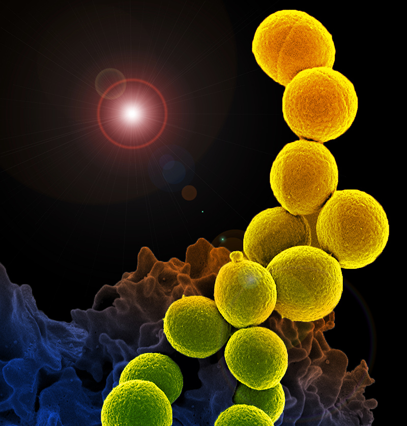 methicillin-resistant Staphylococcus aureus (MRSA) bacteria