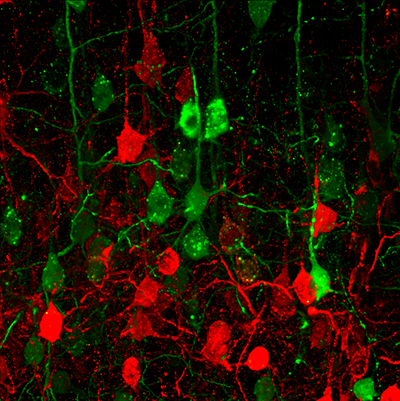 Stem cells were tagged with red or green fluorescent protein, colors that lit up in their descendant cells. Scientists found striking differences in the electrical and physical characteristics of the different neurons. Photo courtesy of Tarik Haydar