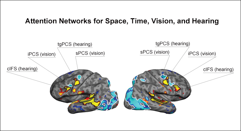 Attention Networks for Space, Time, Vision, and Hearing: The alternating pattern of blue and yellow splotches on this fMRI indicates visual (blue) and auditory (yellow) attention regions in the brain. Somers and Michalka named the newly discovered auditory regions tgPCS and cIFS. “No one has seen this very clear interleaved pattern before,” says Michalka.