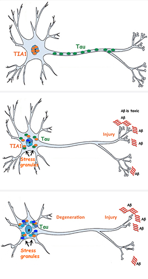 Graphic showing the Tau mechanism in healthy, stressed and degenerative states