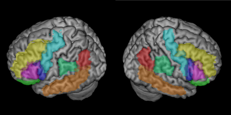 MRI images showing brain activity in different areas of the brain