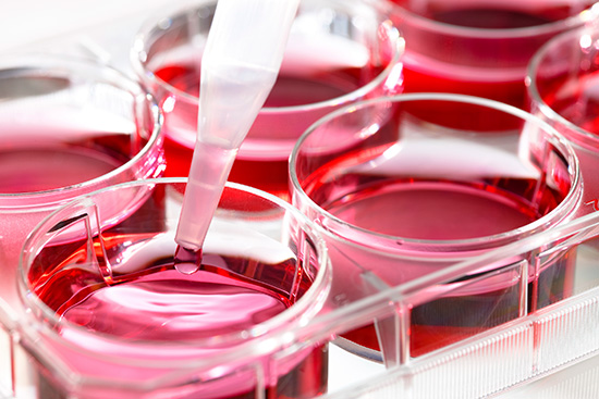 cell culture in petri dishes