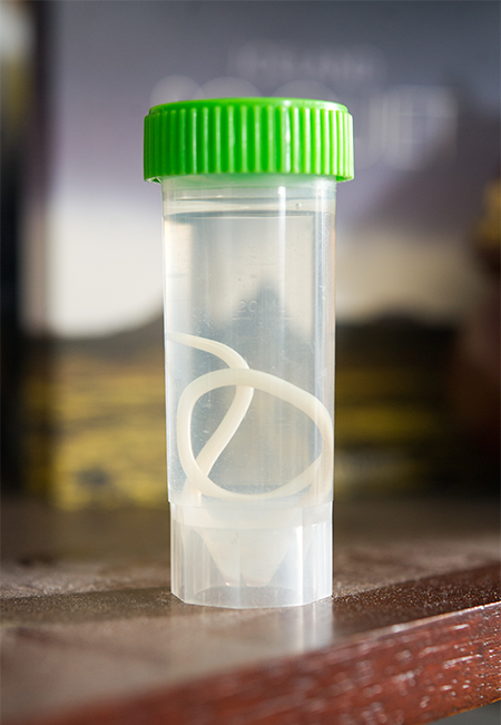 Sample of ascaris intestinal roundworm in the office of Angela Jackson, Associate Dean, Boston University School of Medicine