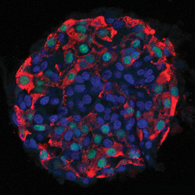 Beta Cells
