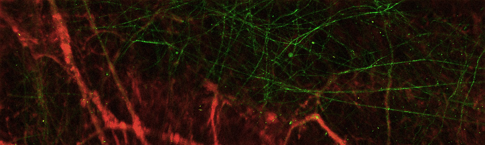 Tumor Vasculature