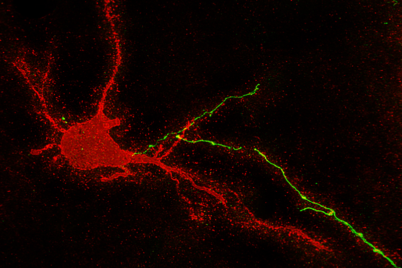neurons in the human brain