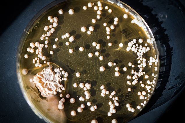 Bacterial colonies grown from Kombucha in a petri dish to be used for probiotics research