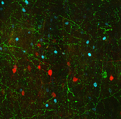 Neurons from area 25, seen in green, terminate on branching dendrites in an area associated with attention and emotions.
