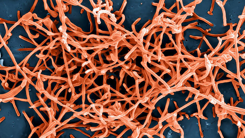 microscopic image of ebola virus