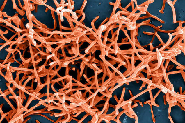 microscopic image of ebola virus