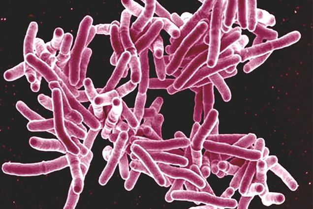 Microscopic image of tuberculosis bacteria