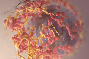 microscopic view of melanoma