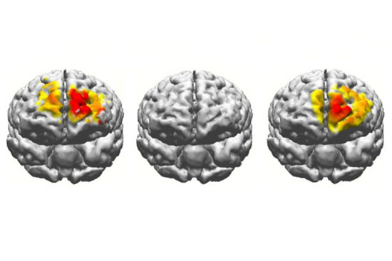 Graphic illustration showing 3 brain scans comparing the brain activity of a 20 year old, a 70 year old, and a 70 year old having undergone electrostimulation.