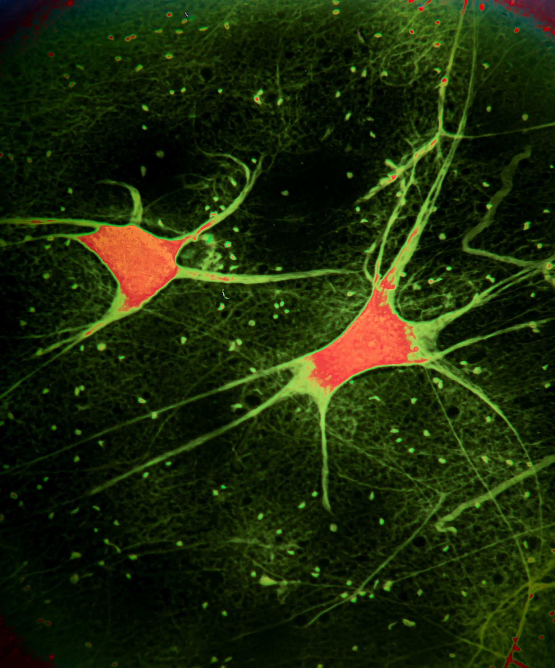 illustration of electrically active brain cells and neurons