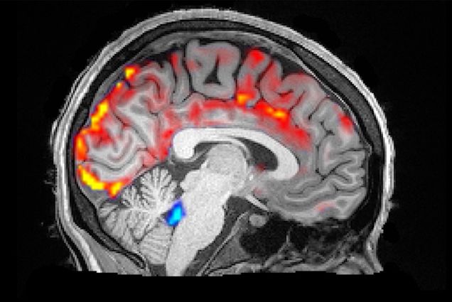 MRI scan of a human brain showing blood flow and cerebrospinal fluid pulses during sleep.