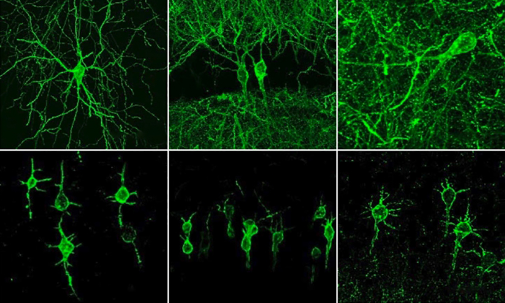 Image of neurons genetically engineered with the fluorescing molecule, SomArchon.