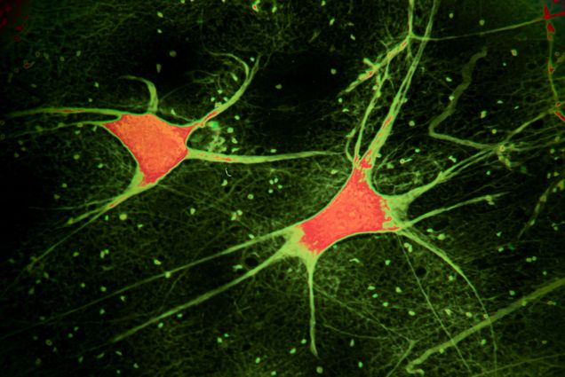 illustration of electrically active brain cells and neurons