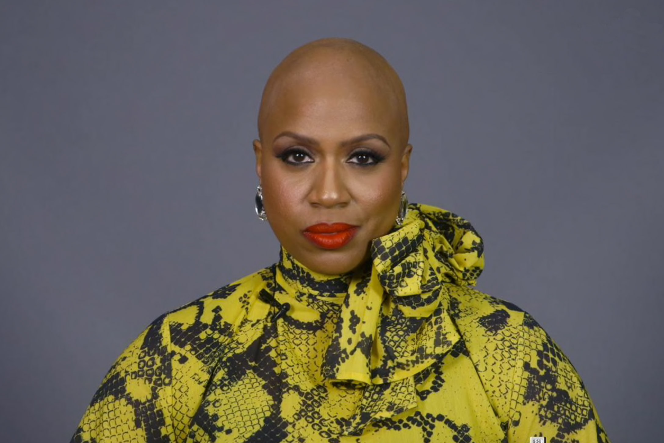 Ayanna Pressley Opens Up About Hair Loss From Alopecia Areata pic picture