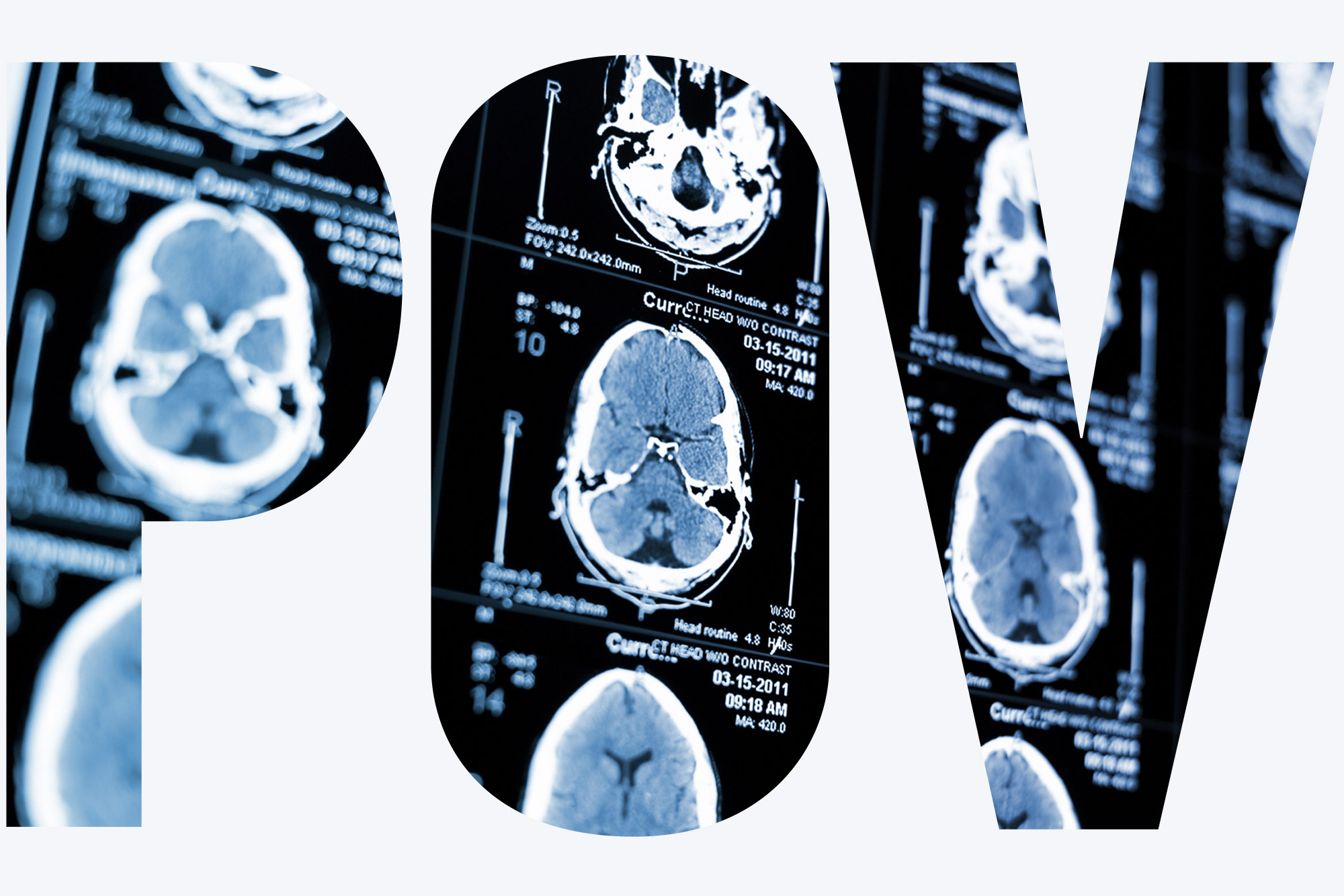 "POV" displayed using an image of a series of CAT scans showing the human head