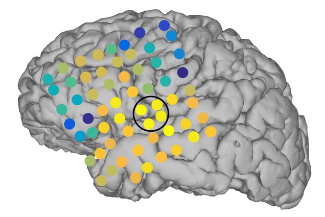 An image showing how brain networks propagate and evolve leading up to and during seizures.