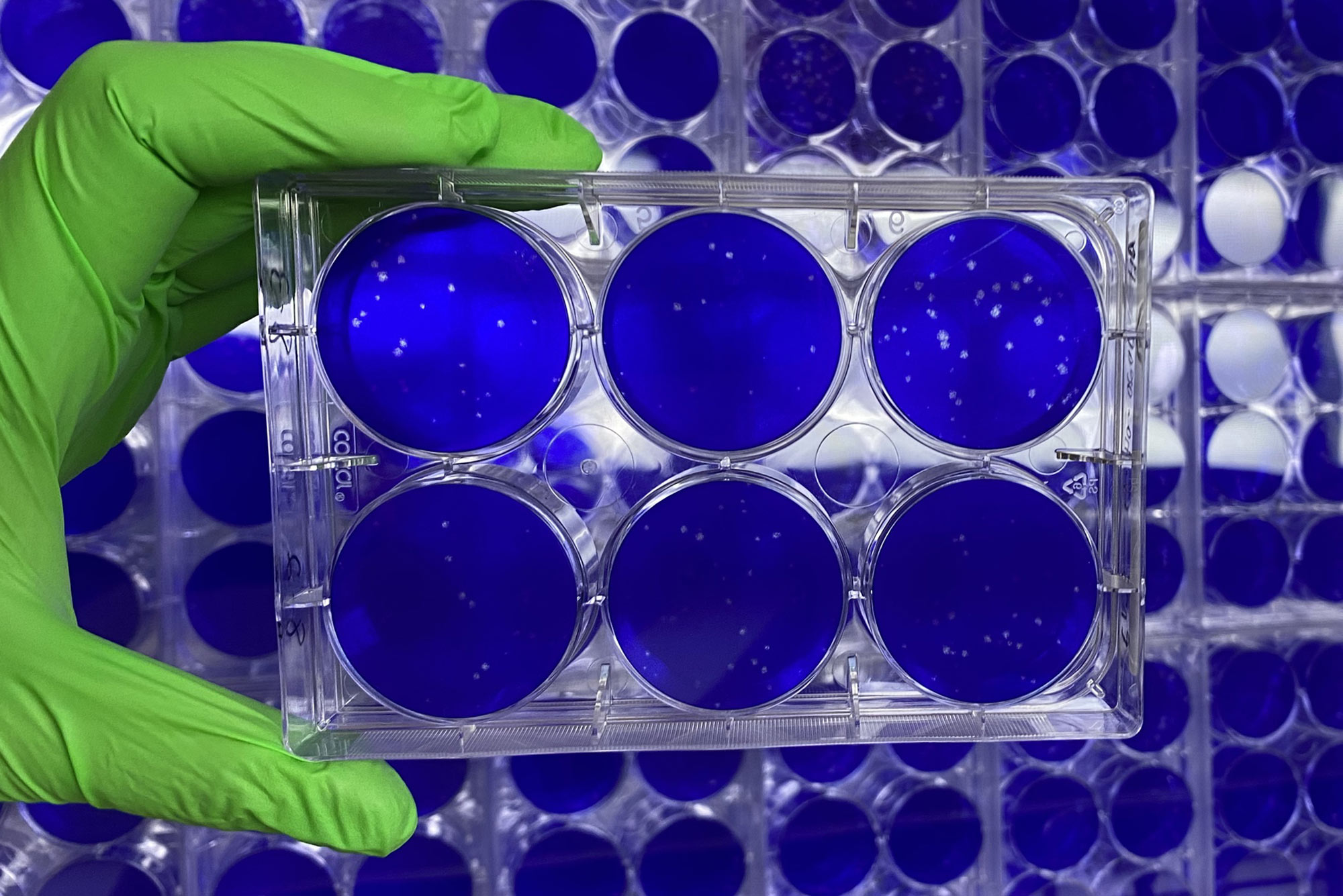 nanosponges containing fragments of lung cell membranes in a cell culture in a NEIDL laboratory