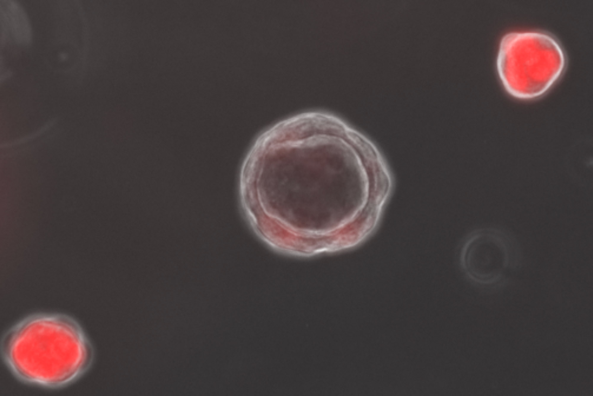 An image of red organoids on a gray background