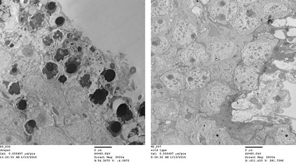 Electron micrographs of normal brain tissue (right) and brain tissue from a fly that can't clear dead cells, shown by the black spots. Image courtesy of McCall