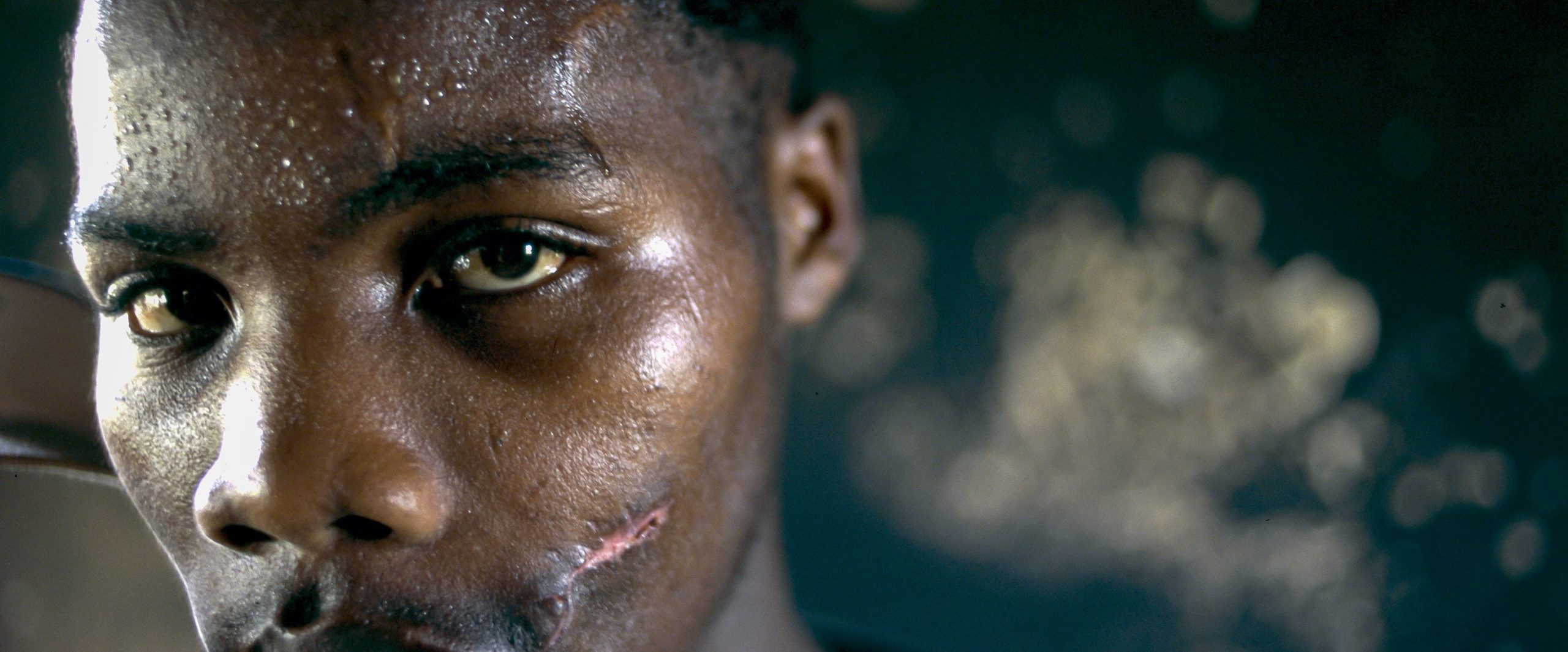 A 1996 portrait of an African National Congress supporter who was shot in the face and had his home burned the year before. 