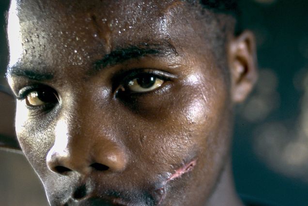 A 1996 portrait of an African National Congress supporter who was shot in the face and had his home burned the year before.