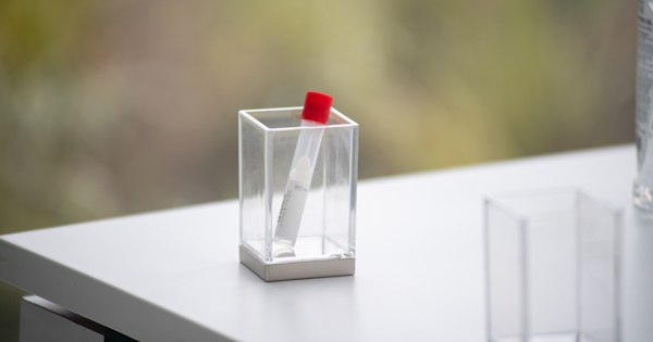 Photo of a single covid test vial with a swab in it with a red cap at the test collection at the Rajen Kilachand Center August 25, 2020.