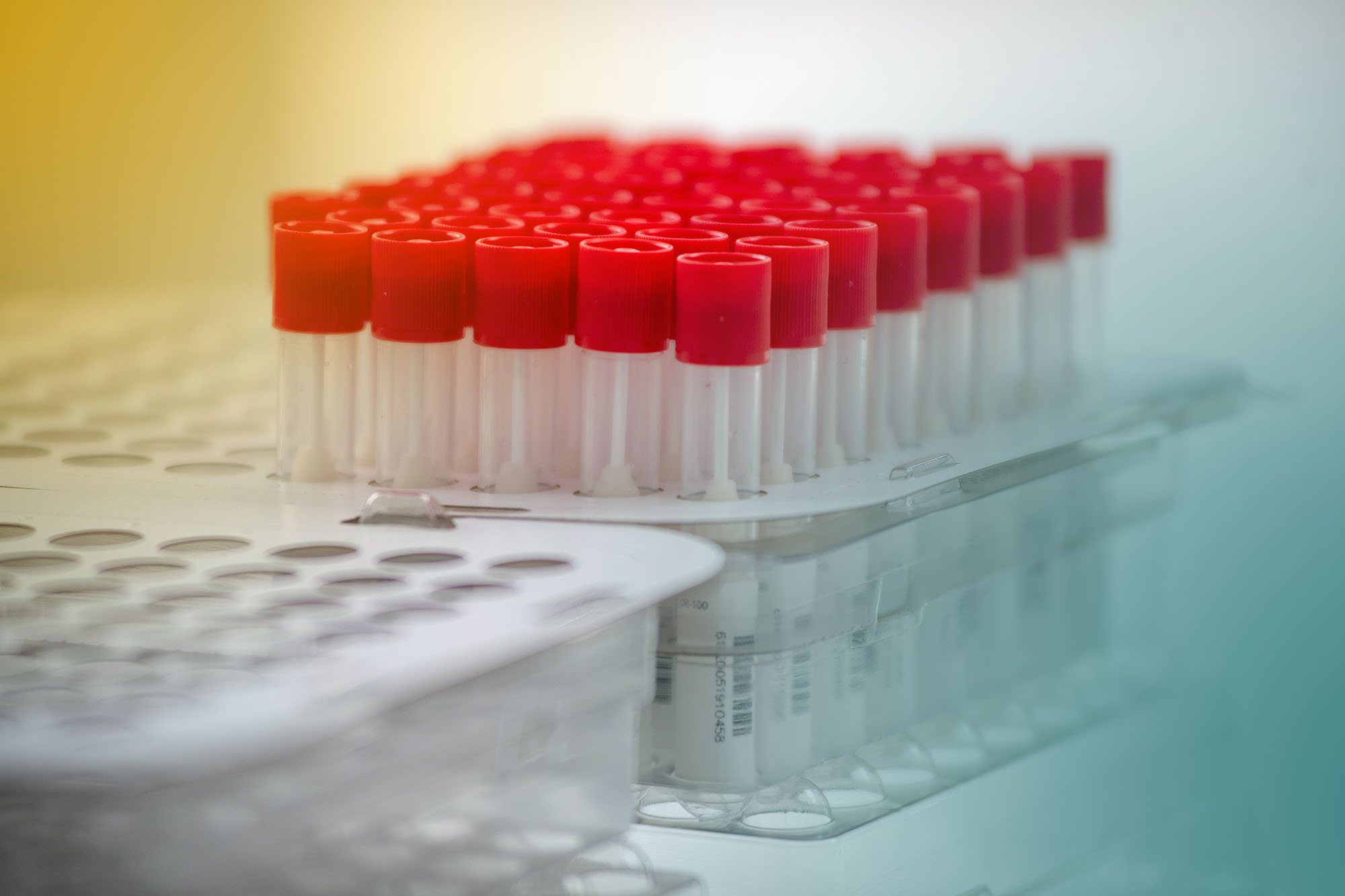 Detail photo of a tray of nasal swabs for COVID-19 testing in containers with red caps. The photo is tinted yellow and teal.