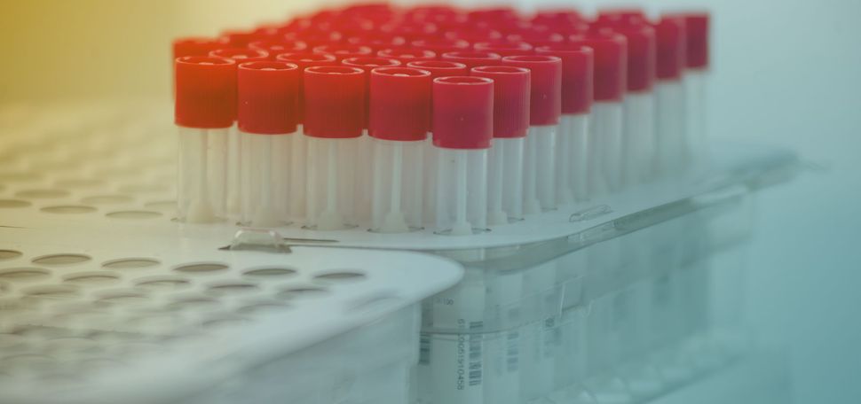 Detail photo of a tray of nasal swabs for COVID-19 testing in containers with red caps. The photo is tinted yellow and teal.