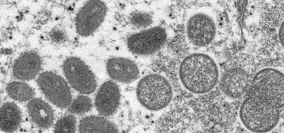 Image: Electron microscope image of various virions (virus particles) of the monkeypox virus taken from human skin, 2003. Various grey blobs and specks are seen on a clear film.