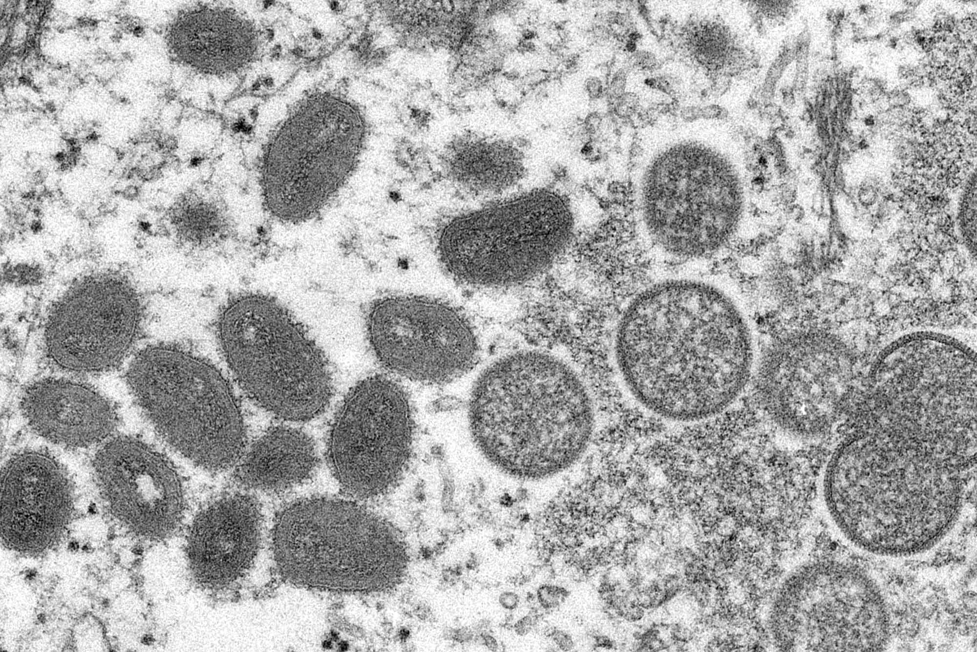 Image: Electron microscope image of various virions (virus particles) of the monkeypox virus taken from human skin, 2003. Various grey blobs and specks are seen on a clear film.