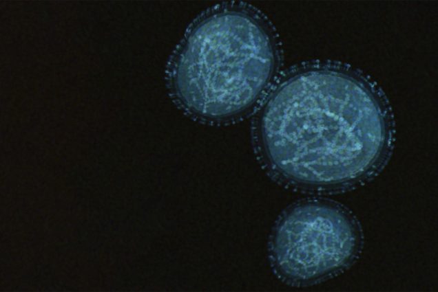 A microscope image of the monkeypox virus, showing small cells with a blue hue