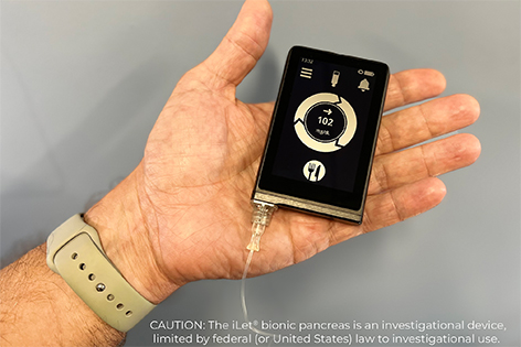 Bionic Pancreas Better for Managing Type 1 Diabetes - Vimarsana News