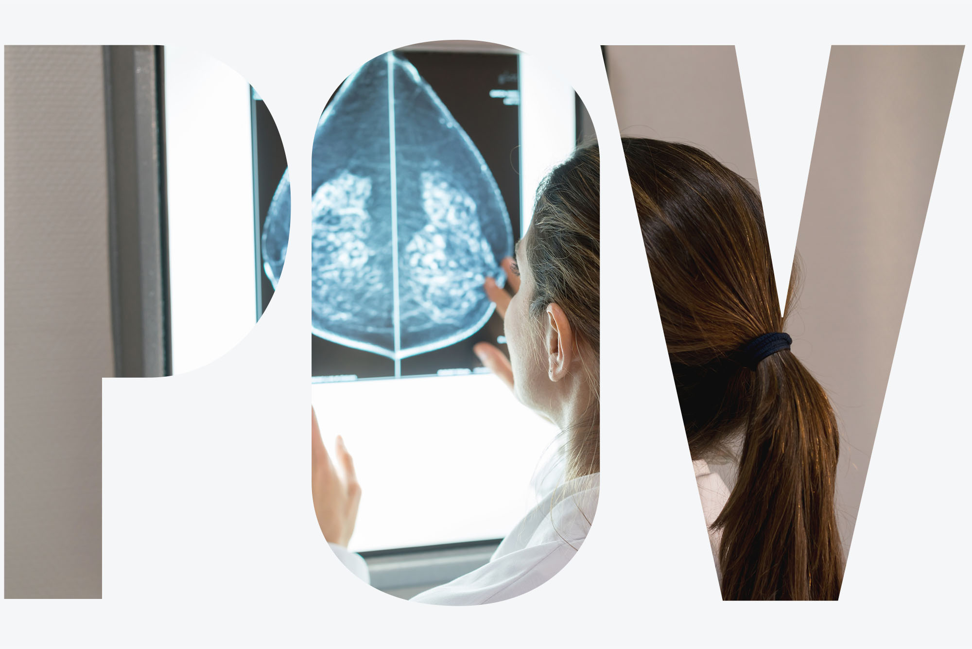 An oncologist reviews an x-ray image of a breast cancer patient's chest. The letters "POV" are overlaid on top of the image
