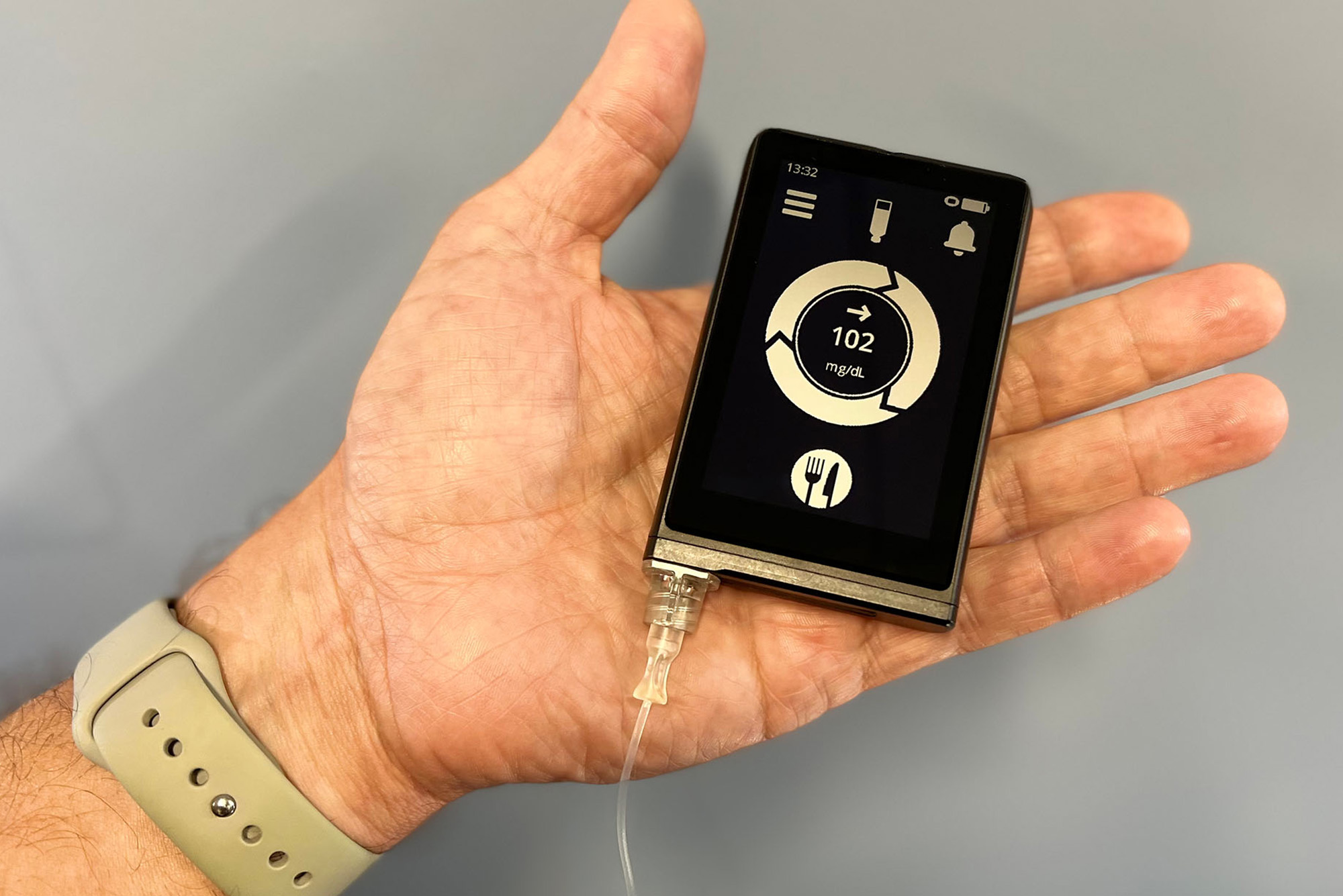 Image: Photo of The iLet bionic pancreas, which automatically monitors blood glucose levels and delivers tailored insulin doses. A hand displays a small black device with gold details and display with gold buttons. Display shows the blood glucose reading and has a symbol of food on it. Text on image reads "CAUTION: The iLet bionic pancreas is an investigational device, limited by federal (or United states) law to investigational use."