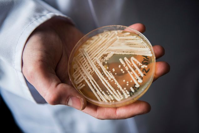 Photo: A white hands holds up a petri dish holding the yeast candida auris in a laboratory. a Petri dish with speckles of white dots/fungi is shown.