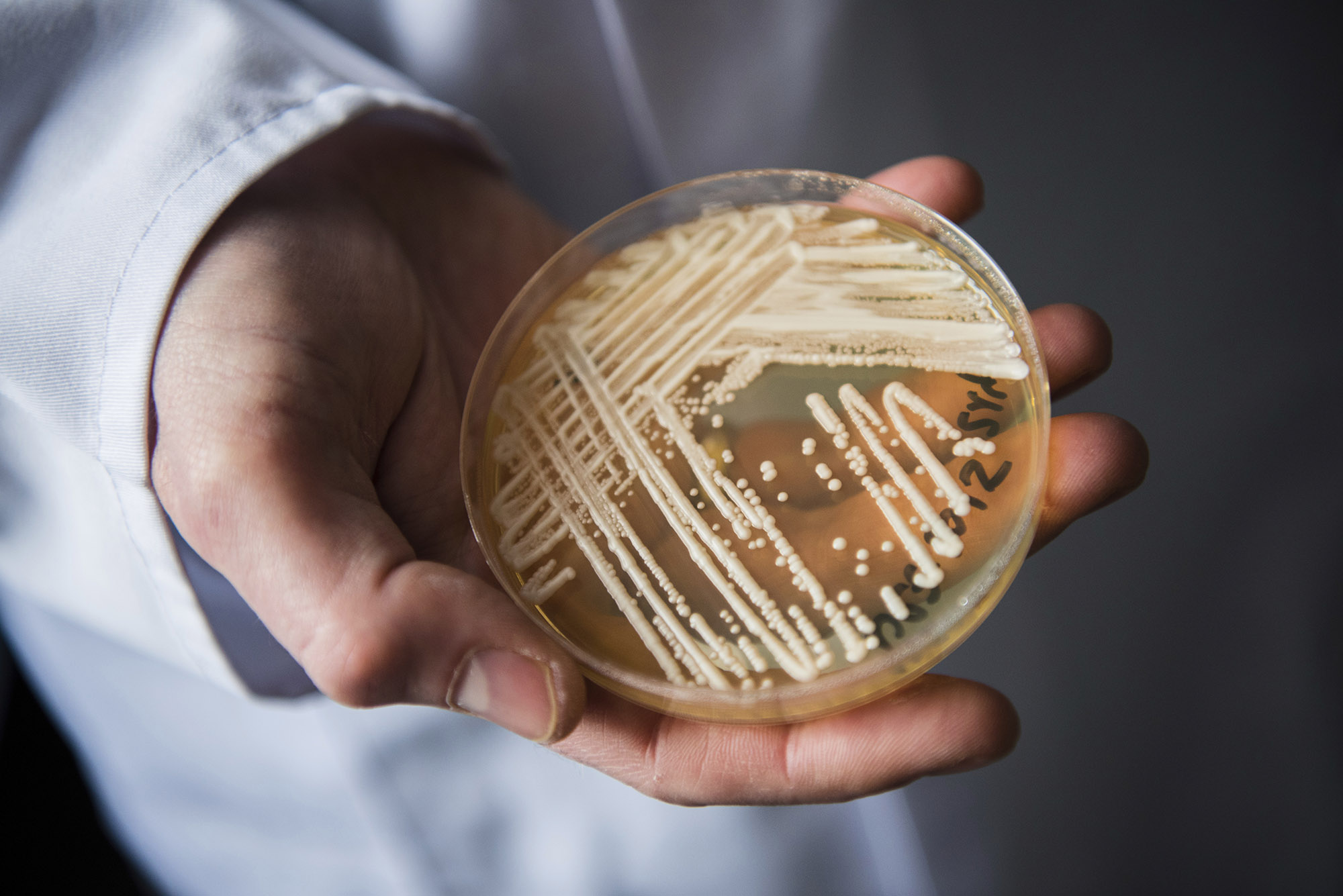 Photo: A white hands holds up a petri dish holding the yeast candida auris in a laboratory. a Petri dish with speckles of white dots/fungi is shown.