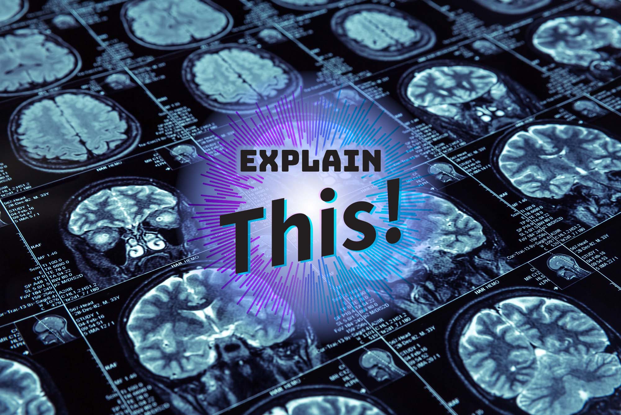 Photo: An array of brain scans with a text overlay reading "Explain This!"