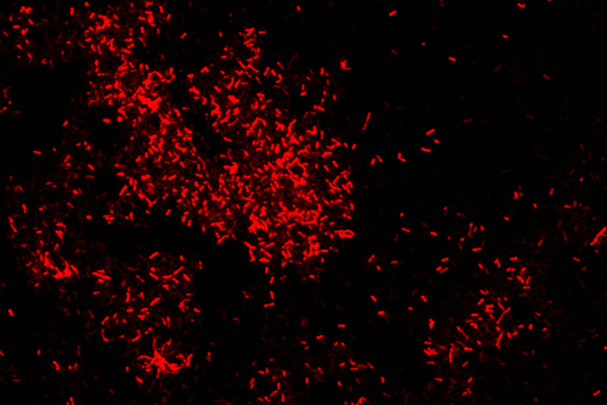 Photo: Microbes under a microscope, they appear as red and scattered