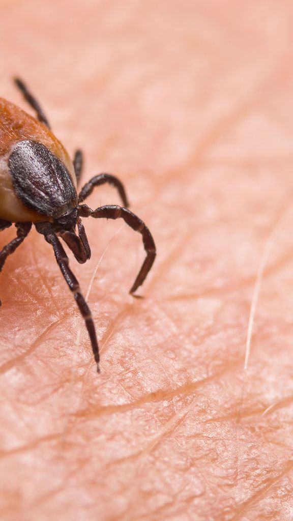 Photo: A stock photo of a deer tick zoomed in on skin.
